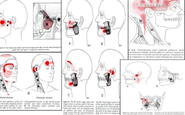 fisioterapia ATM