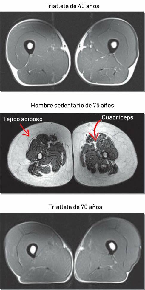 tercera edad fisioterapia rehabilitacion