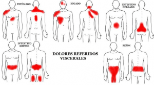 dolor visceral